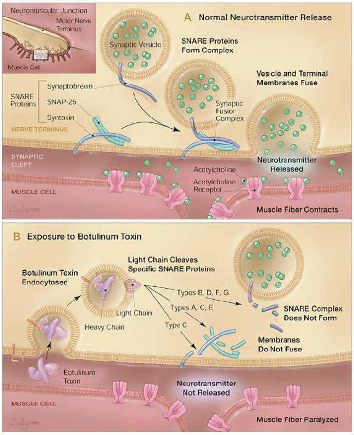 clostridium botulinum toxinok