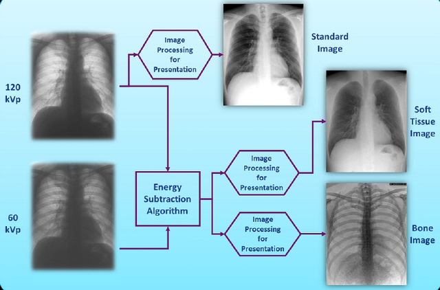 Figure 1: Dual Energy Subtraction Image Production Flowchart