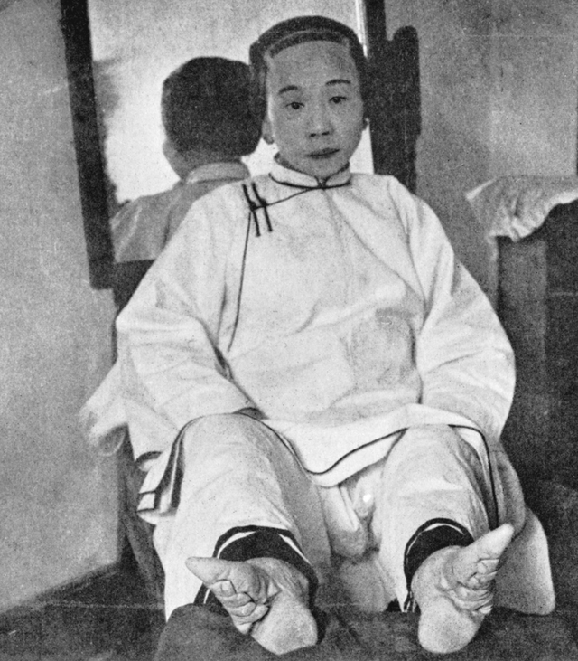 Chinese woman with bound feet